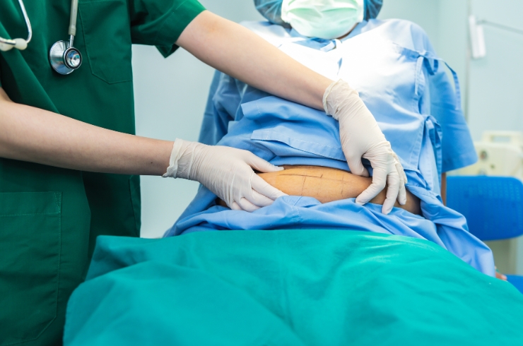 SURGICAL GASTROENTEROLOGY-------14